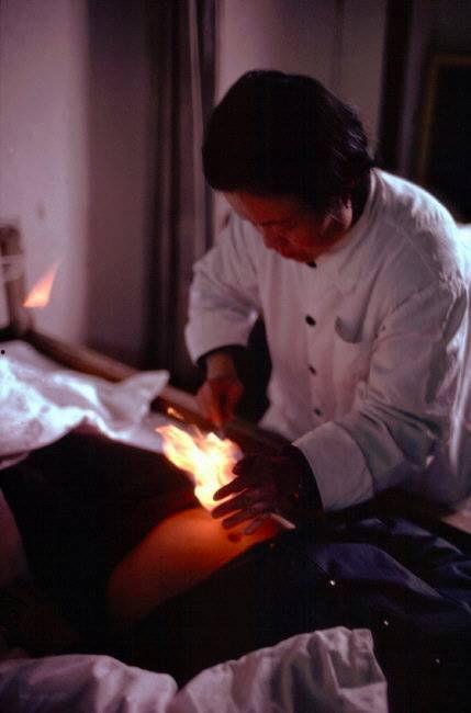 老中医做针灸视频爆料